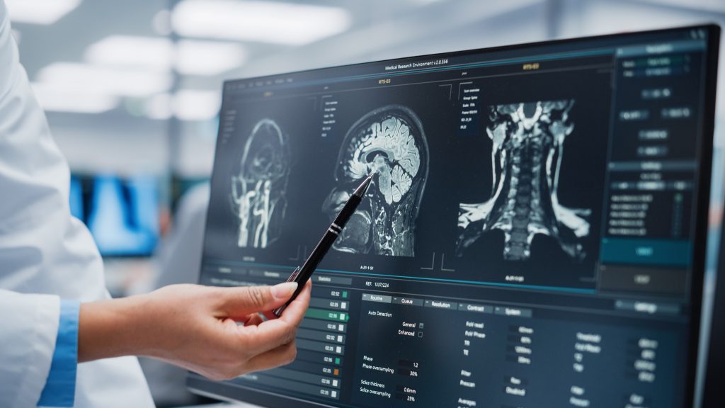 Onderzoek naar parkinson en atypische parkinsonismen